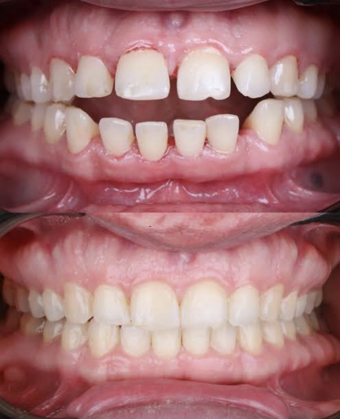 Orthodontics