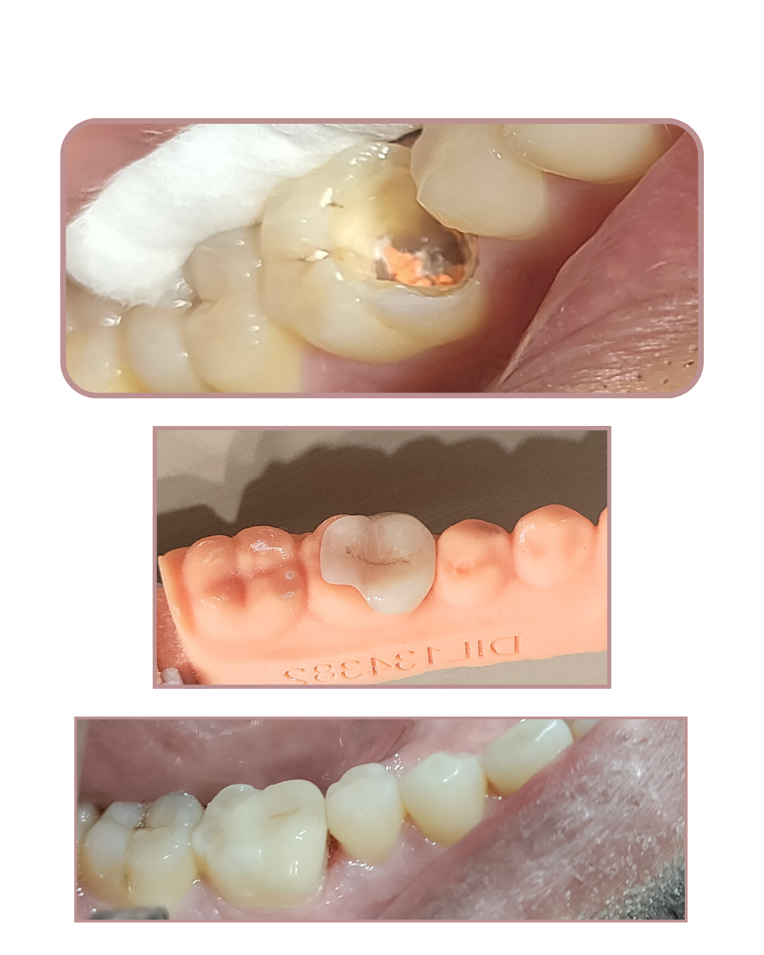 Biomimetic Dentistry